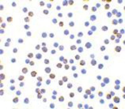 Immunocytochemistry/Immunofluorescence: XBP1 Antibody [NBP1-77253] - HepG2 cells with XBP-1 antibody at 10 ug/ml.