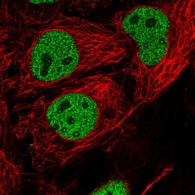 Immunocytochemistry/Immunofluorescence: SOX6 Antibody [NBP1-85811] - Immunofluorescent staining of human cell line CACO-2 shows localization to nucleoplasm.