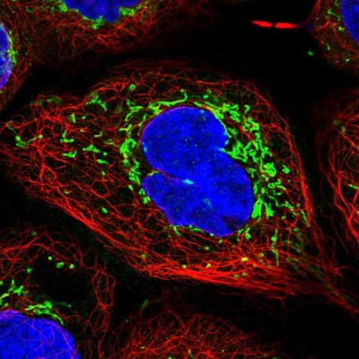 Immunocytochemistry/Immunofluorescence: TIMM44 Antibody [NBP1-86941] - Immunofluorescent staining of human cell line A-431 shows localization to mitochondria.