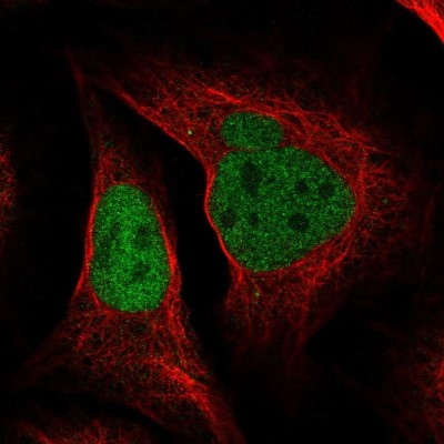 Immunocytochemistry/Immunofluorescence: DNA polymerase delta p50 Antibody [NBP1-90925] - Immunofluorescent staining of human cell line U-2 OS shows localization to nucleoplasm.