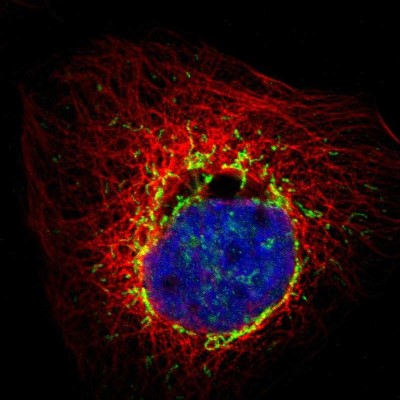 Immunocytochemistry/Immunofluorescence: PMPCA Antibody [NBP1-89126] - Immunofluorescent staining of human cell line A-431 shows localization to mitochondria.