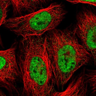 Immunocytochemistry/Immunofluorescence: hnRNP AB Antibody [NBP1-91999] - Immunofluorescent staining of human cell line U-2 OS shows localization to nucleoplasm.