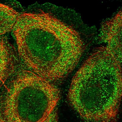 Immunocytochemistry/Immunofluorescence: KMT2D Antibody [NBP1-89123] - Immunofluorescent staining of human cell line A-431 shows localization to nucleus, plasma membrane & cytosol.