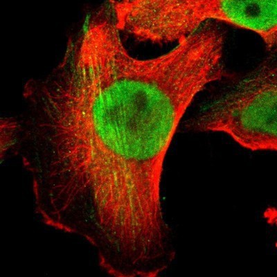 Immunocytochemistry/Immunofluorescence: hnRNP H2 Antibody [NBP1-89817] - Staining of human cell line U-251MG shows positivity in nucleus but not nucleoli and cytoskeleton (actin filaments).
