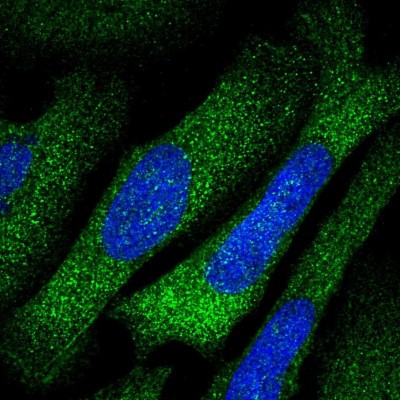 Immunocytochemistry/Immunofluorescence: TARS Antibody [NBP1-89427] - Immunofluorescent staining of human cell line U-2 OS shows localization to cytosol & actin filaments.