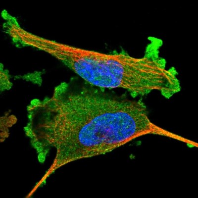 Immunocytochemistry/Immunofluorescence: Adenylosuccinate Synthase Antibody [NBP1-90360] - Immunofluorescent staining of human cell line U-251 MG shows localization to plasma membrane & cytosol.