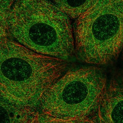Immunocytochemistry/Immunofluorescence: FATP3/SLC27A3 Antibody [NBP1-89265] - Staining of human cell line MCF7 shows localization to endoplasmic reticulum.