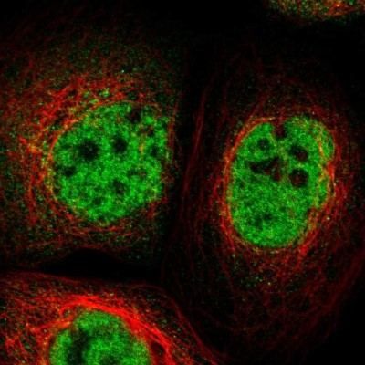 Immunocytochemistry/Immunofluorescence: TOX4 Antibody [NBP1-88433] - Immunofluorescent staining of human cell line A-431 shows localization to nucleoplasm.