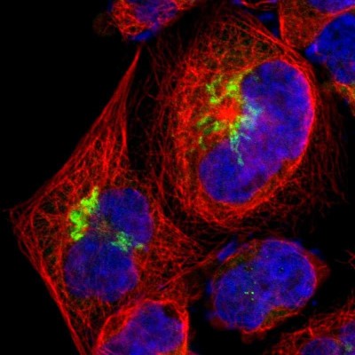 Immunocytochemistry/Immunofluorescence: beta-1,4-Galactosyltransferase 1/B4GalT1 Antibody [NBP1-88654] - Immunofluorescent staining of human cell line A-431 shows localization to the Golgi apparatus.