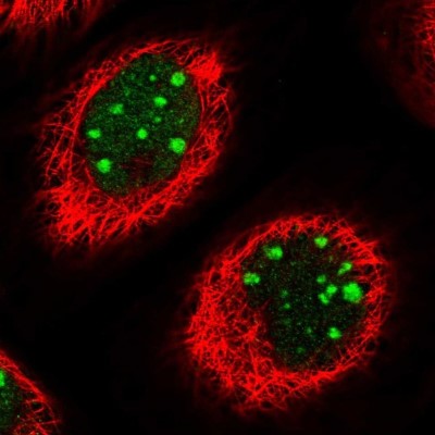 Immunocytochemistry/Immunofluorescence: TBL3 Antibody [NBP1-92481] - Staining of human cell line A-431 shows localization to nucleus & nucleoli.