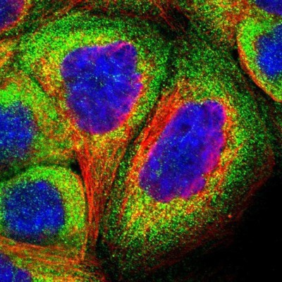 Immunocytochemistry/Immunofluorescence: TRIOBP Antibody [NBP1-90589] - Staining of human cell line A-431 shows positivity in cytoplasm.