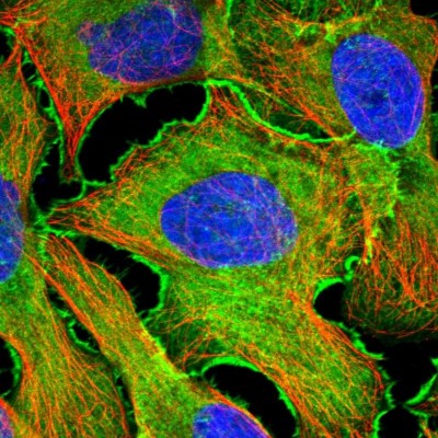 Immunocytochemistry/Immunofluorescence: EPLIN Antibody [NBP1-87947] - Immunofluorescent staining of human cell line U-2 OS shows localization to plasma membrane, cytosol & actin filaments.