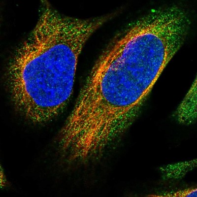 Immunocytochemistry/Immunofluorescence: NCKAP1 Antibody [NBP1-83269] - Immunofluorescent staining of human cell line U-2 OS shows localization to cytosol.