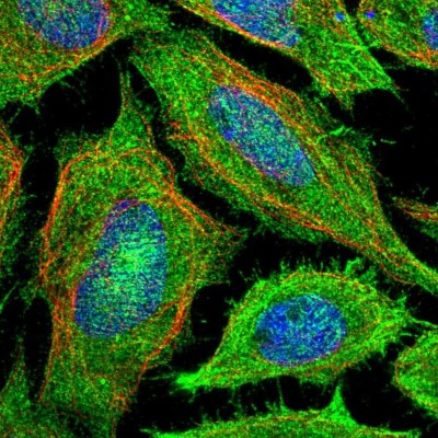 Immunocytochemistry/Immunofluorescence: PAWR / PAR4 Antibody [NBP1-87338] - Immunofluorescent staining of human cell line SiHa shows localization to plasma membrane & actin filaments.