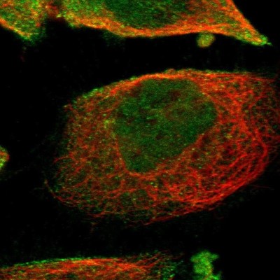 Immunocytochemistry/Immunofluorescence: WDR13 Antibody [NBP1-85820] - Staining of human cell line A-431 shows localization to nucleoplasm & plasma membrane.