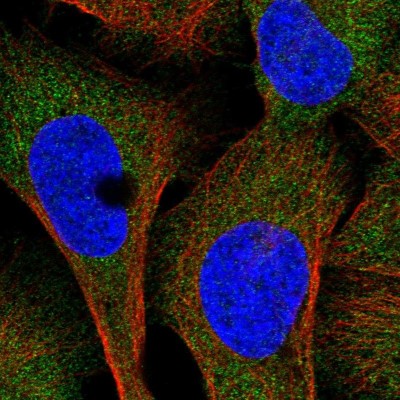 Immunocytochemistry/Immunofluorescence: UMPS Antibody [NBP1-85896] - Immunofluorescent staining of human cell line U-2 OS shows localization to cytosol.