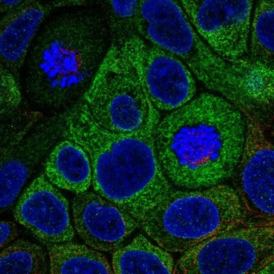 Immunocytochemistry/Immunofluorescence: HSD17B2 Antibody [NBP1-92011] - Staining of human cell line RT4 shows localization to endoplasmic reticulum.