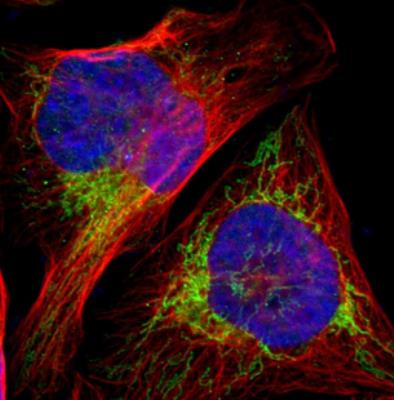 Immunocytochemistry/Immunofluorescence: HSD17B2 Antibody [NBP1-92011] - Staining of human cell line.