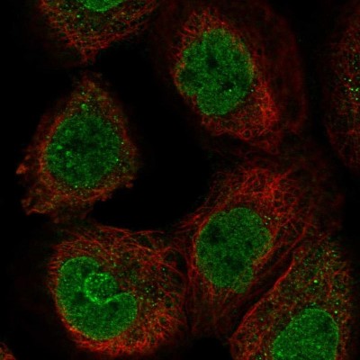 Immunocytochemistry/Immunofluorescence: FZR1/CDH1 Antibody [NBP1-91774] - Immunofluorescent staining of human cell line A-431 shows localization to nucleoplasm & nuclear membrane.