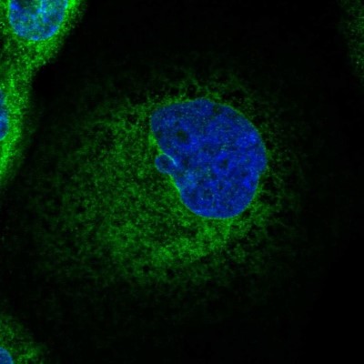 Immunocytochemistry/Immunofluorescence: CCDC47 Antibody [NBP1-93717] - Immunofluorescent staining of human cell line A-431 shows localization to endoplasmic reticulum.