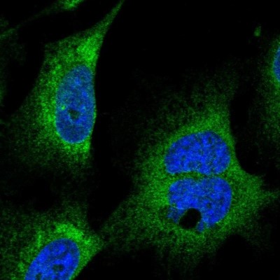Immunocytochemistry/Immunofluorescence: CCDC47 Antibody [NBP1-93717] - Staining of human cell line U-251MG shows positivity in endoplasmic reticulum.
