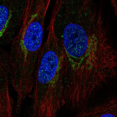 Immunocytochemistry/Immunofluorescence: COX-1 Antibody [NBP1-85500] - Immunofluorescent staining of human cell line BJ shows localization to the Golgi apparatus.