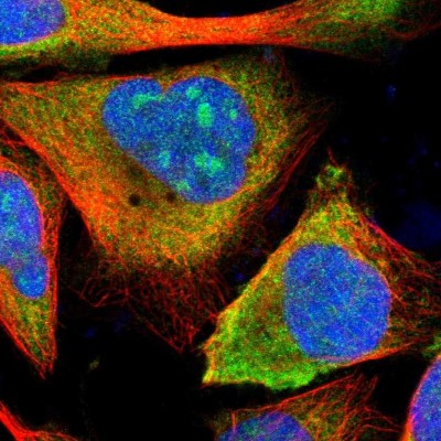 Immunocytochemistry/Immunofluorescence: ETV6/Tel Antibody [NBP1-80695] - Immunofluorescent staining of human cell line U-2 OS shows localization to nucleoli & cytosol.