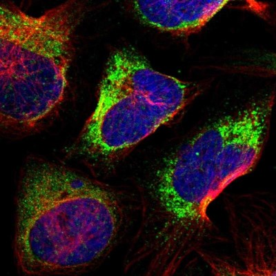 Immunocytochemistry/Immunofluorescence: P4HA2 Antibody [NBP2-33878] - Immunofluorescent staining of human cell line U-2 OS shows localization to endoplasmic reticulum & vesicles.