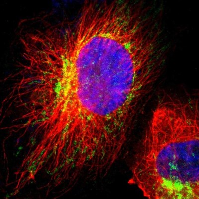 Immunocytochemistry/Immunofluorescence: HCCS Antibody [NBP1-86577] - Immunofluorescent staining of human cell line U-251 MG shows localization to mitochondria.