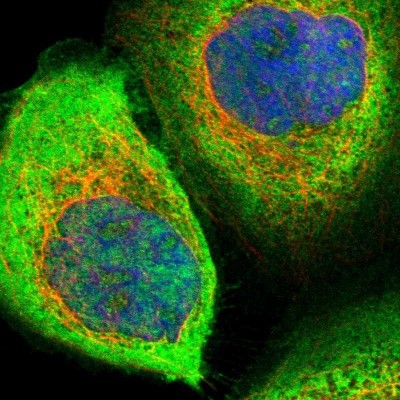 Immunocytochemistry/Immunofluorescence: ZNF313 Antibody [NBP1-87204] - Immunofluorescent staining of human cell line A-431 shows localization to plasma membrane & cytosol.