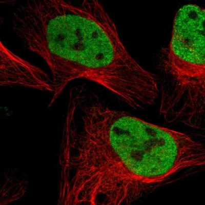 Immunocytochemistry/Immunofluorescence: SMARCC2/BAF170 Antibody [NBP1-90017] - Immunofluorescent staining of human cell line U-2 OS shows localization to nucleoplasm.