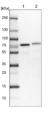 Western Blot: Clathrin interactor 1 Antibody [NBP1-85570] - Lane 1: NIH-3T3 cell lysate (Mouse embryonic fibroblast cells)Lane 2: NBT-II cell lysate (Rat Wistar bladder tumour cells)