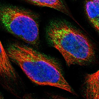 Immunocytochemistry/Immunofluorescence: PNPLA8 Antibody [NBP1-83098] - Immunofluorescent staining of human cell line U-2 OS shows localization to nucleoplasm, cytosol & the Golgi apparatus.