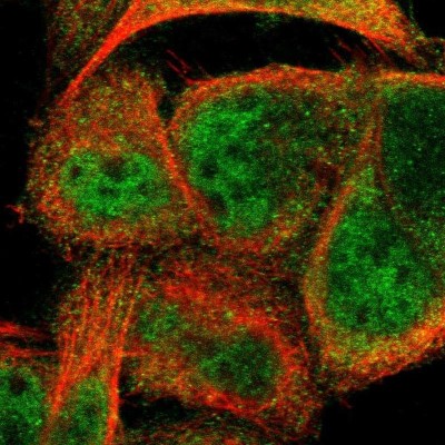 Immunocytochemistry/Immunofluorescence: CCDC22 Antibody [NBP1-84331] - Staining of human cell line A-431 shows localization to nucleoplasm & cytosol.