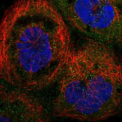 Immunocytochemistry/Immunofluorescence: TRAPPC2L Antibody [NBP1-83172] - Immunofluorescent staining of human cell line A-431 shows localization to cytosol & vesicles.