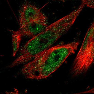 Immunocytochemistry/Immunofluorescence: CPSF2 Antibody [NBP1-82910] - Immunofluorescent staining of human cell line U-251 MG shows localization to nucleoplasm.