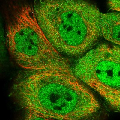 Immunocytochemistry/Immunofluorescence: DNAJB4 Antibody [NBP1-81735] - Immunofluorescent staining of human cell line A-431 shows localization to nucleoplasm, plasma membrane & cytosol.