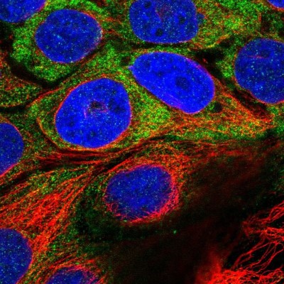 Immunocytochemistry/Immunofluorescence: USH1C Antibody [NBP1-89190] - Immunofluorescent staining of human cell line CACO-2 shows localization to cytosol.