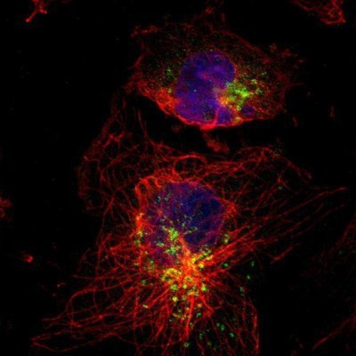 Immunocytochemistry/Immunofluorescence: ATP6V1B2 Antibody [NBP1-88890] - Staining of human cell line U-251MG shows positivity in golgi apparatus and vesicles.