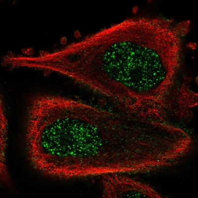 Immunocytochemistry/Immunofluorescence: ABLIM3 Antibody [NBP1-81471] - Staining of human cell line PC-3 shows localization to nucleoplasm & plasma membrane.
