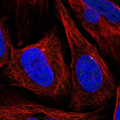 Immunocytochemistry/Immunofluorescence: CEP164 Antibody [NBP1-81445] - Staining of human cell line U-2 OS shows localization to centrosome.