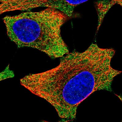 Immunocytochemistry/Immunofluorescence: AIMP2 Antibody [NBP1-81575] - Immunofluorescent staining of human cell line A549 shows localization to cytosol.
