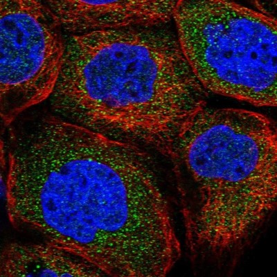 Immunocytochemistry/Immunofluorescence: CNOT10 Antibody [NBP1-82278] - Staining of human cell line A-431 shows positivity in cytoplasm.