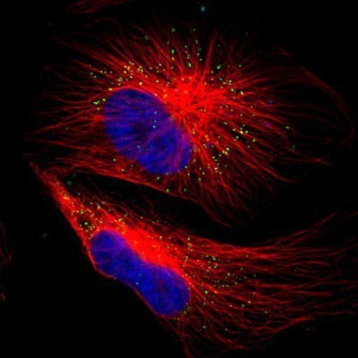 Immunocytochemistry/Immunofluorescence: ACAA1 Antibody [NBP1-85786] - Staining of human cell line U-251MG shows positivity in vesicles.