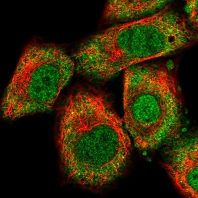 Immunocytochemistry/Immunofluorescence: RBM47 Antibody [NBP1-83664] - Immunofluorescent staining of human cell line A549 shows localization to nucleoplasm & cytosol.