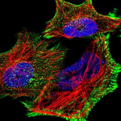 Immunocytochemistry/Immunofluorescence: PDLIM7 Antibody [NBP1-84841] - Immunofluorescent staining of human cell line U-251 MG shows localization to actin filaments & focal adhesion sites.
