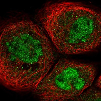 Immunocytochemistry/Immunofluorescence: SUPT5H Antibody [NBP1-83508] - Immunofluorescent staining of human cell line A-431 shows localization to nucleoplasm.