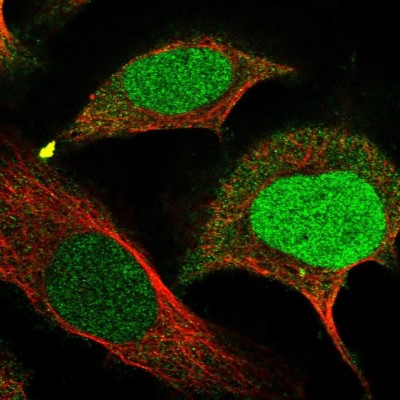 Immunocytochemistry/Immunofluorescence: FAM111B Antibody [NBP1-86645] - Immunofluorescent staining of human cell line U-2 OS shows localization to nucleus & cytosol.