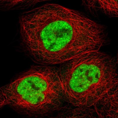 Immunocytochemistry/Immunofluorescence: RBM10 Antibody [NBP1-84951] - Immunofluorescent staining of human cell line A-431 shows localization to nuclear speckles.