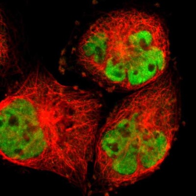 Immunocytochemistry/Immunofluorescence: RBM14 Antibody [NBP1-84416] - Immunofluorescent staining of human cell line A-431 shows localization to nuclear speckles.